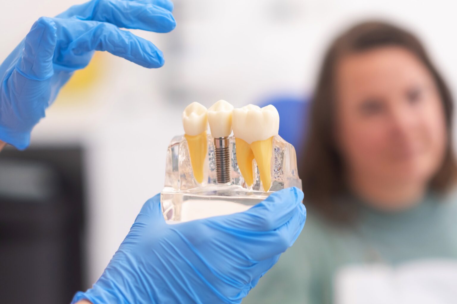 Dental Implants in Laurel, MD
