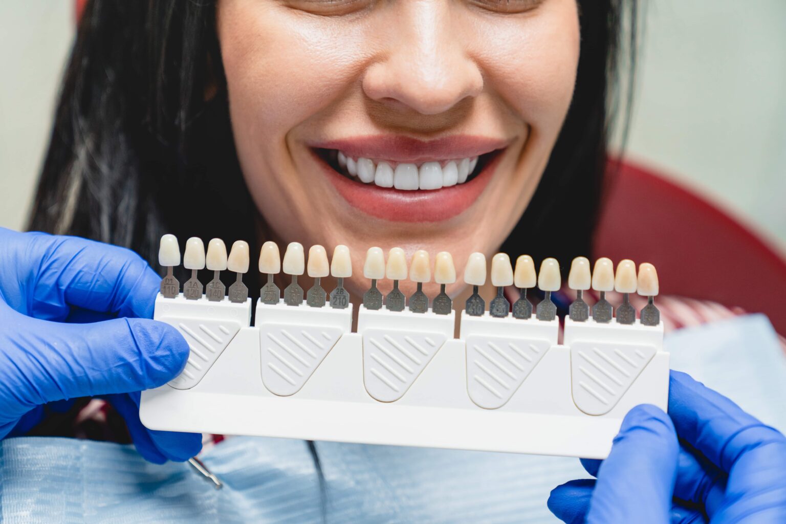 Porcelain Veneers in Laurel, MD Porcelain Veneers in Laurel, MD