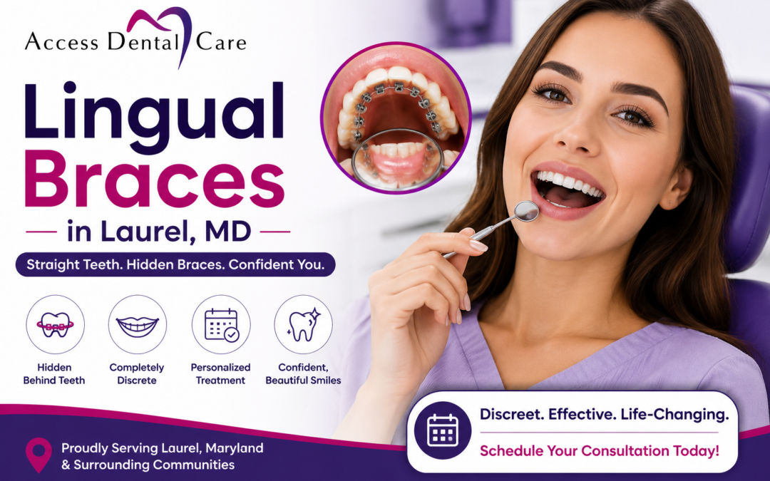 Lingual Braces in Laurel MD